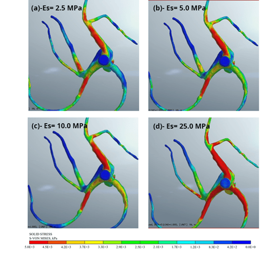 Figure 11 Scenarios analyzed depending of the saddle extension